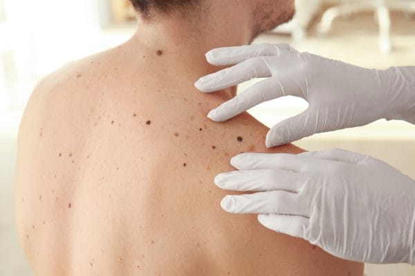 dermatologist examining patient in clinic