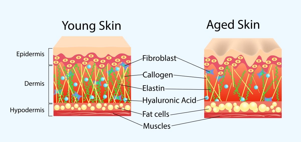 vector diagram with schemes of two types of skin, for healthcare illustrations