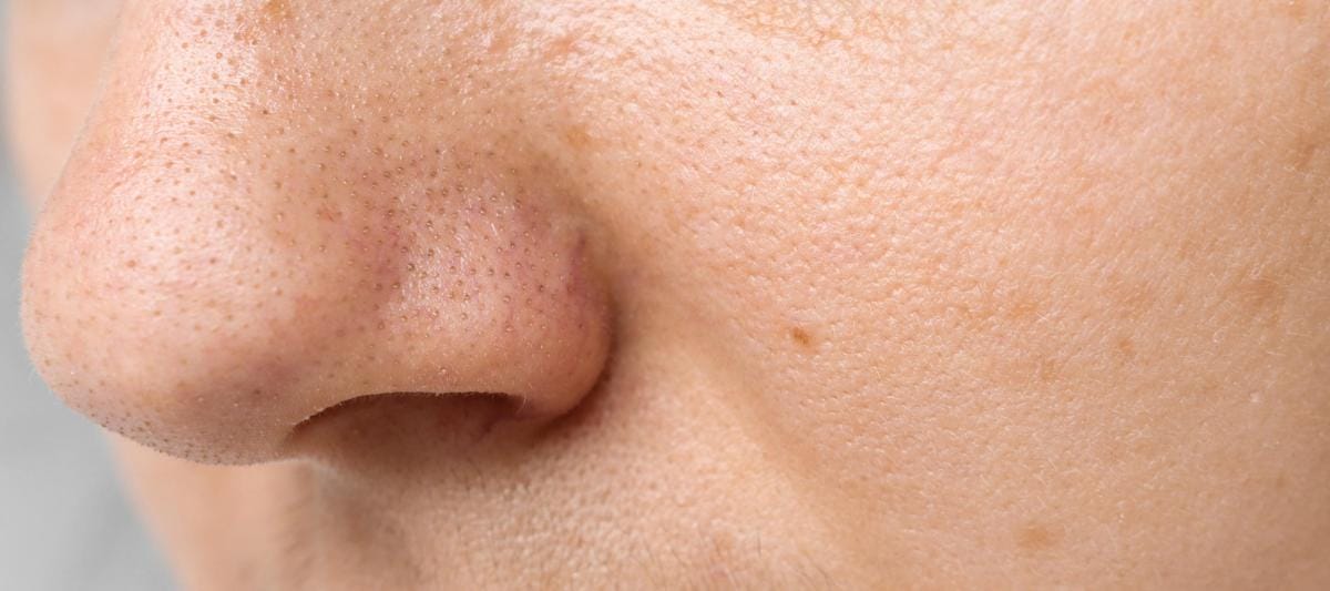 Close-up of human nose showing skin texture