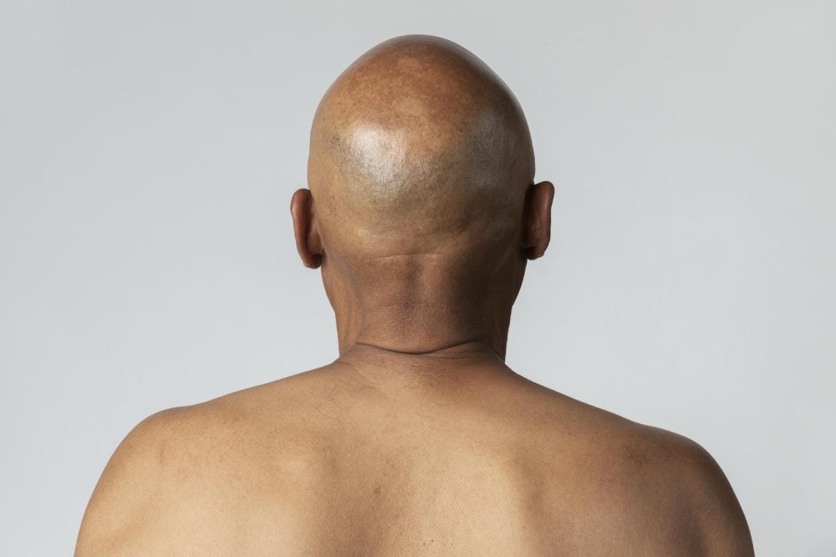 Bald man viewed from behind against plain background