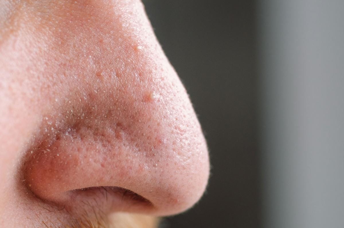 Close-up of a human nose with visible pores