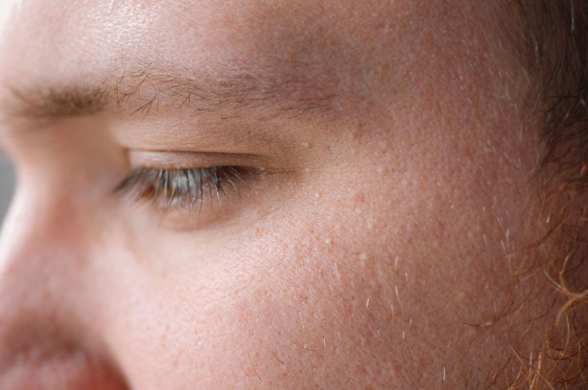 Close-up of person's eye and textured skin