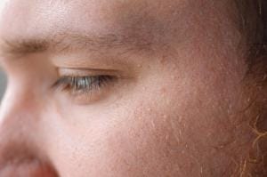 Close-up of person's eye and textured skin